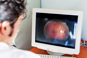 a young ophthalmologist looking at a retina scan in a computer monitor